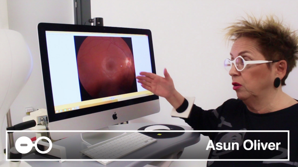 ¿Cómo podemos detectar el glaucoma en las ópticas?